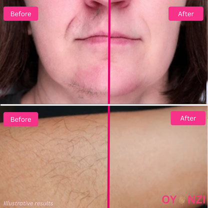 Oyanzi™ Hair Reduction Oil