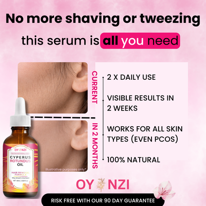 Oyanzi™ Hair Reduction Oil