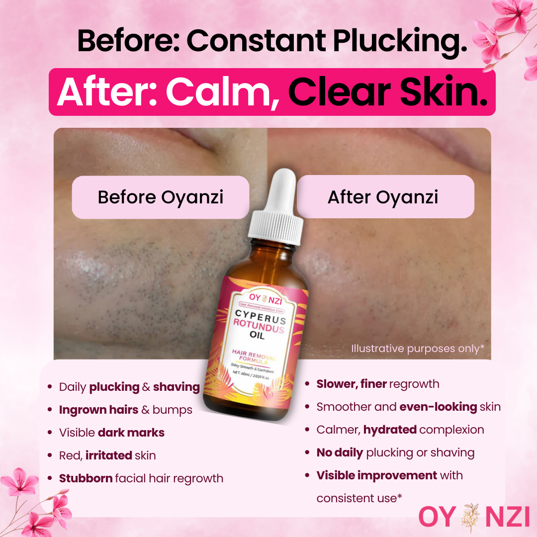 OYANZI Cyperus Rotundus Oil